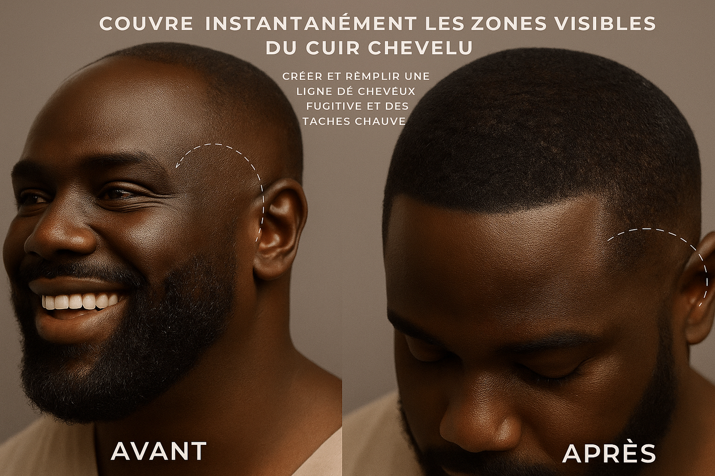 Fibre capillaire|Camouflage instantané